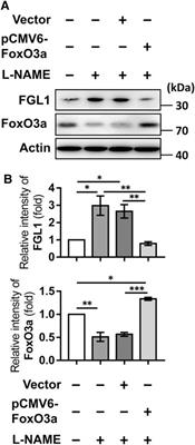 Upregulation of Fibrinogen-Like 1 Expression Contributes to Reducing the Progression of Preeclampsia